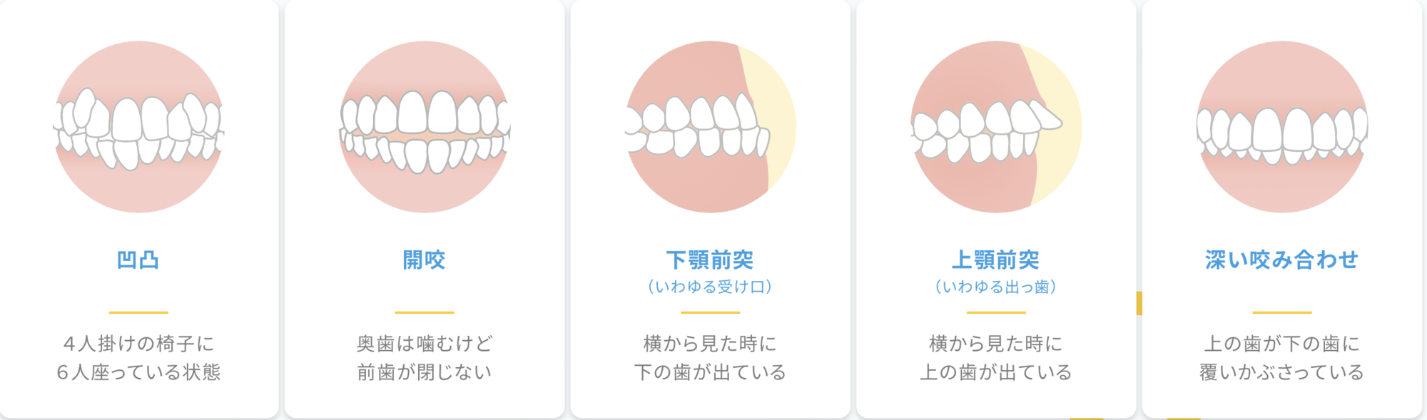 歯並びを改善します